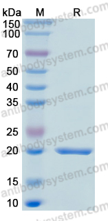 Recombinant Human GADD45A Protein, N-His