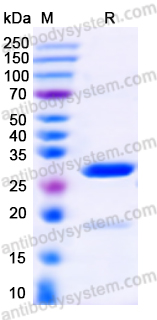 Recombinant Human EDNRB/ETRB Protein, N-GST & C-His