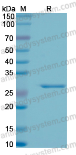 Recombinant Human EEF1B2 Protein, N-His