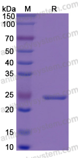 Recombinant Human IGFBP6 Protein, N-His