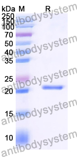 Recombinant Human IGFBP6 Protein, N-His-SUMO