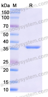 Recombinant Human ACAT1 Protein, N-His