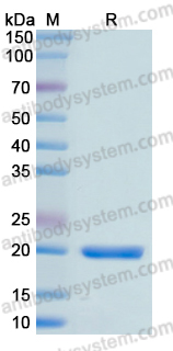 Recombinant Human MYL9 Protein, N-His