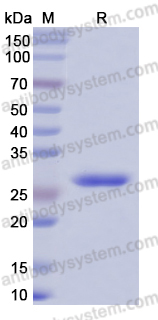 Recombinant Human DNASE1 Protein, N-His