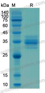 Recombinant Human CDK2 Protein, N-His