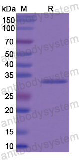 Recombinant Human COL8A2 Protein, N-His