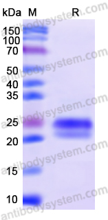 Recombinant Human EDNRA Protein, N-His-SUMO