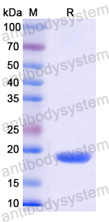 Recombinant Human AZGP1 Protein, N-His