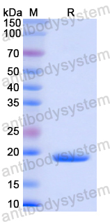 Recombinant Human MPST Protein, N-His