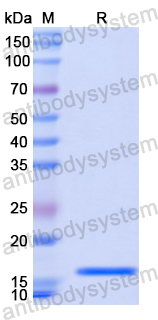 Recombinant Human LAMA1 Protein, N-His