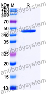 Recombinant Human YY1 Protein, N-His