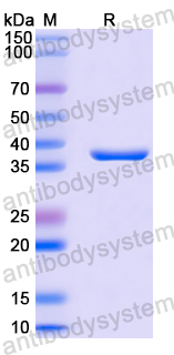 Recombinant Human DNAJB2 Protein, N-GST & C-His