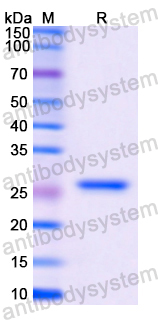 Recombinant Human CTSS Protein, N-His