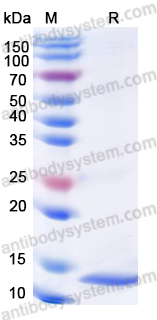 Recombinant Human S100P Protein, N-His