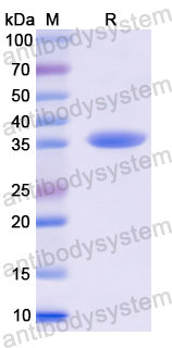 Recombinant Human UCP1 Protein, N-His