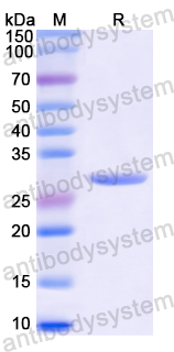 Recombinant Human NFKBIA Protein, N-His