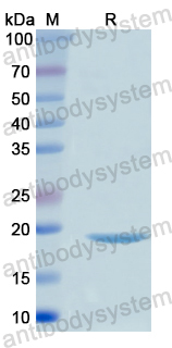 Recombinant Human ITGB8 Protein, N-His