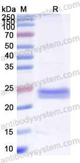 Recombinant Human PTX3 Protein, N-His