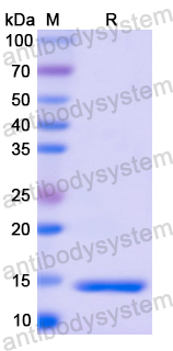 Recombinant Human S100A4 Protein, N-His