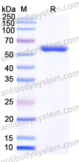 Recombinant Human PTBP1 Protein, N-His