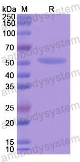 Recombinant Human EEF1G Protein, N-His