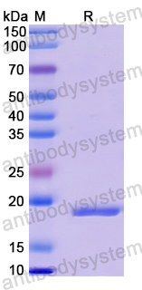 Recombinant Human CD123/IL3RA Protein, N-His