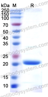 Recombinant Human PON1 Protein, N-His