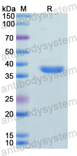 Recombinant Human ANXA13 Protein, N-His