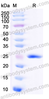 Recombinant Human CBLIF Protein, N-His