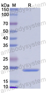 Recombinant Human CALML3 Protein, N-His