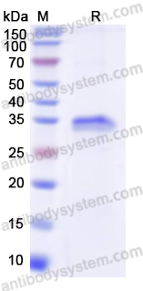 Recombinant Human CD26/DPP4 Protein, N-His