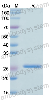 Recombinant Human RPL10 Protein, N-His