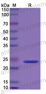 Recombinant Human Calreticulin/CALR Protein, N-His