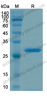 Recombinant Human MAP4 Protein, N-His