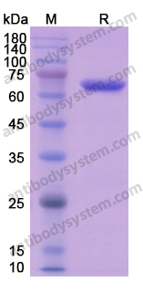 Recombinant Human CANX Protein, N-His