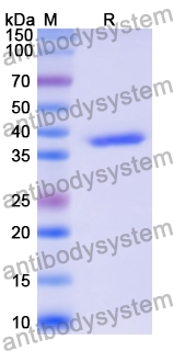 Recombinant Human CD121b/IL1R2/IL-2R beta Protein, N-His