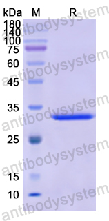 Recombinant Human AOAH Protein, N-His