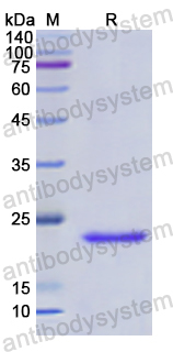 Recombinant Human PSMB8 Protein, N-His