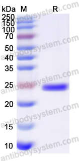 Recombinant Human PSMB5 Protein, N-His