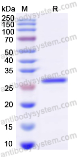 Recombinant Human GSTM2 Protein, N-His