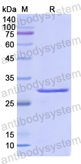 Recombinant Human ABCD3 Protein, N-His