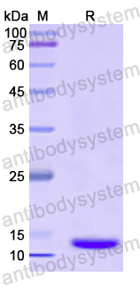 Recombinant Human TMOD1 Protein, N-His