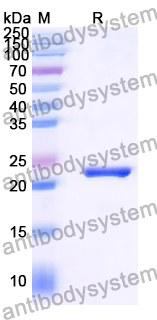 Recombinant Human TMOD1 Protein, N-His