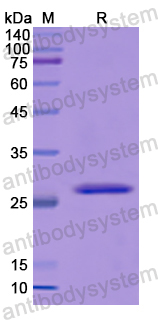 Recombinant Human ITPRID2 Protein, N-His