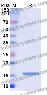 Recombinant Human CST5 Protein, N-His