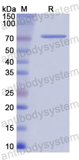 Recombinant Human CHAT Protein, N-His