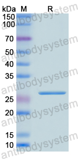 Recombinant Human ACADL Protein, N-His