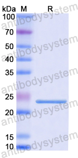 Recombinant Human NDUFS1 Protein, N-His