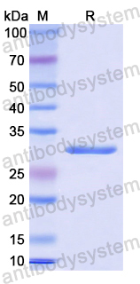 Recombinant Human MAPK1 Protein, N-His