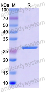 Recombinant Human ERCC5 Protein, N-His